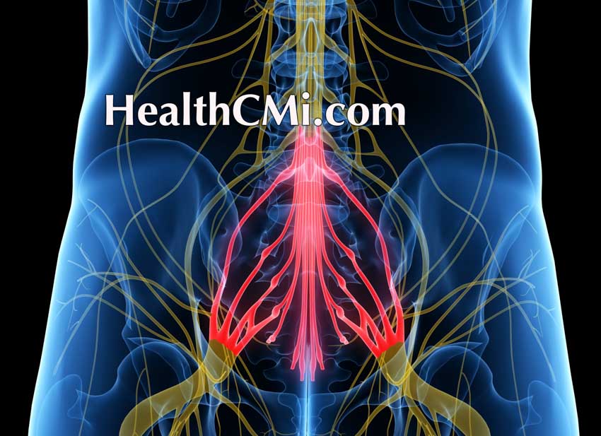 Acupuncture Sciatica Relief with Electroacupuncture